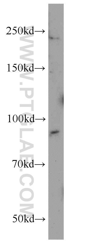 Western Blot (WB) analysis of A2780 cells using Integrin beta-6-Specific Polyclonal antibody (19695-1-AP)