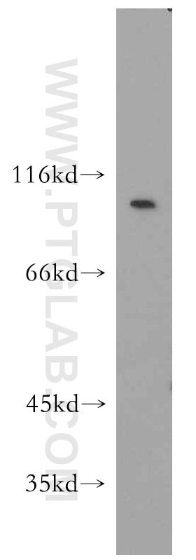 Western Blot (WB) analysis of A549 cells using Integrin beta-6-Specific Polyclonal antibody (19695-1-AP)