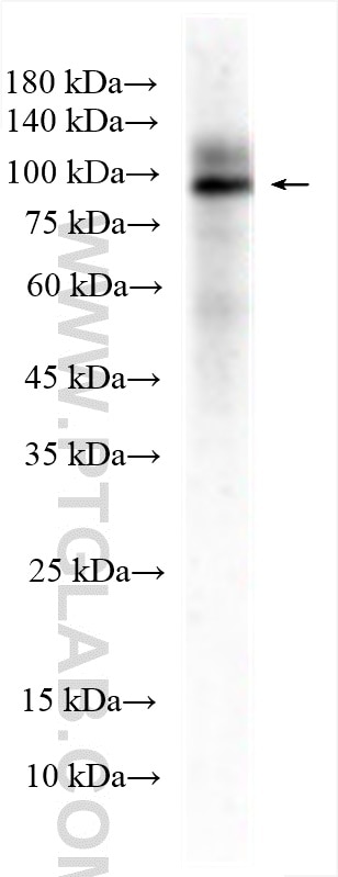 WB analysis of mouse spleen using 11328-1-AP