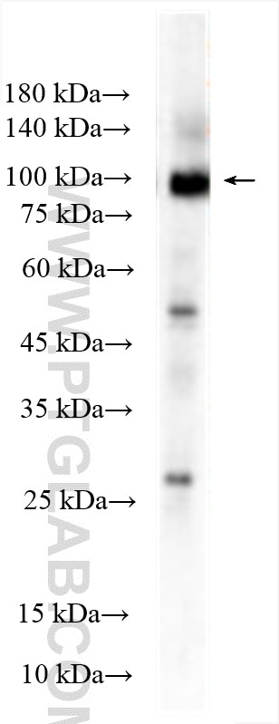 Western Blot (WB) analysis of THP-1 cells using Integrin Beta 7 Polyclonal antibody (11328-1-AP)