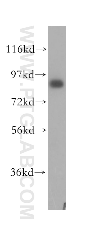 Western Blot (WB) analysis of human lung tissue using Integrin Beta 7 Polyclonal antibody (11328-1-AP)