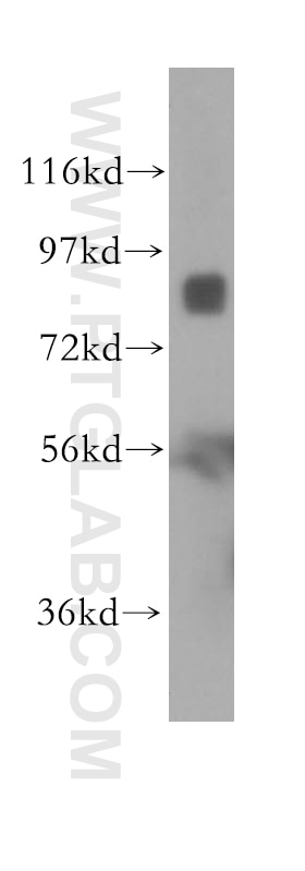 Western Blot (WB) analysis of K-562 cells using Integrin Beta 7 Polyclonal antibody (11328-1-AP)