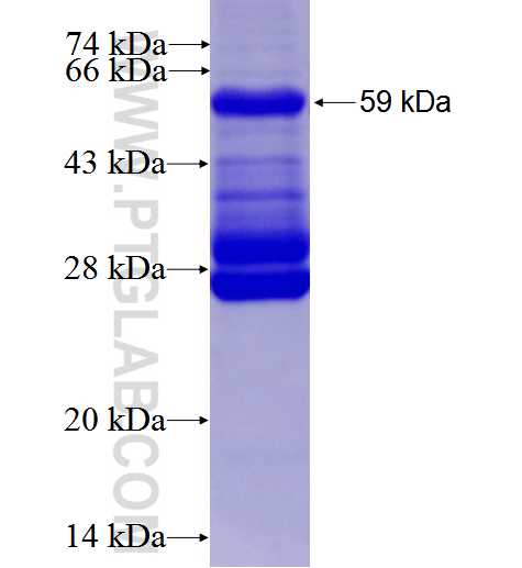 Integrin beta-7 fusion protein Ag1871 SDS-PAGE