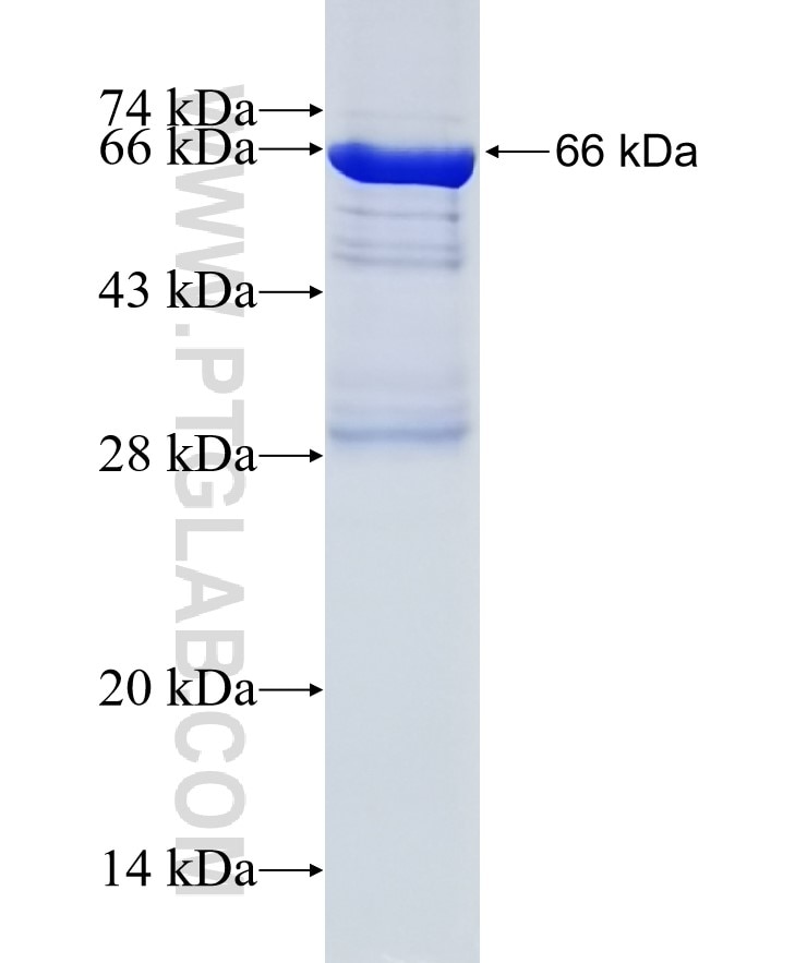 Integrin beta-8 fusion protein Ag7585 SDS-PAGE