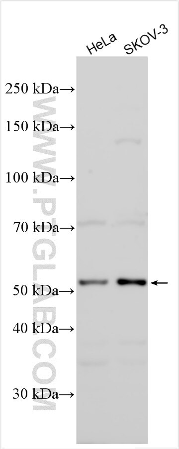 Western Blot (WB) analysis of various lysates using ITGBL1 Polyclonal antibody (30010-1-AP)