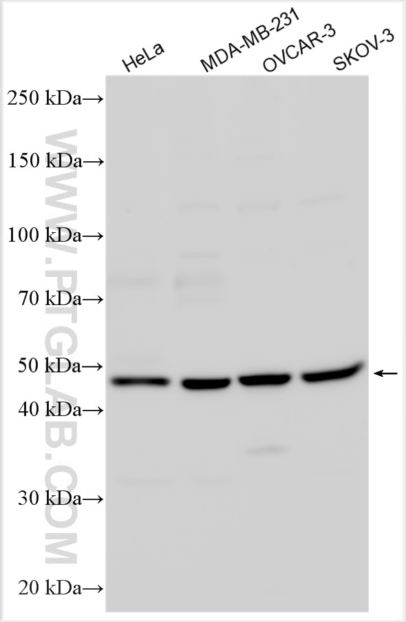 Western Blot (WB) analysis of various lysates using ITGBL1 Polyclonal antibody (30010-1-AP)