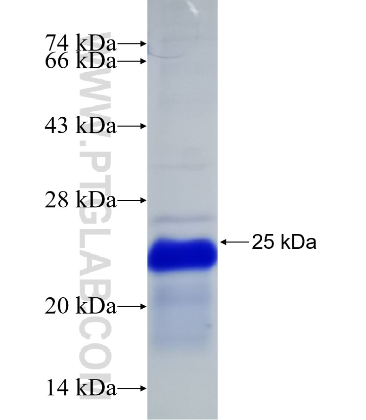 ITGBL1 fusion protein Ag31989 SDS-PAGE