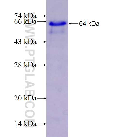 ITGBL1 fusion protein Ag11521 SDS-PAGE