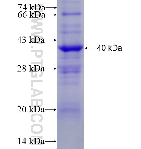 ITGBL1 fusion protein Ag11558 SDS-PAGE