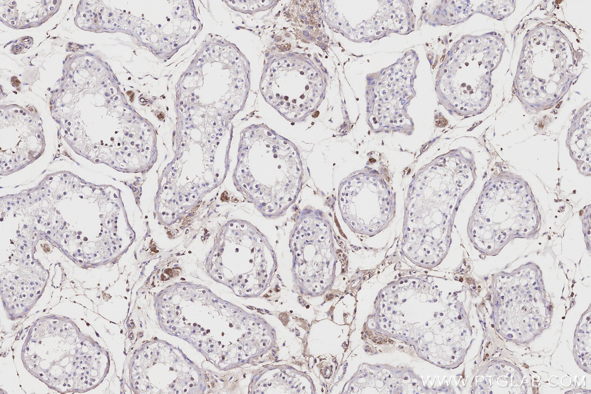 IHC staining of human testis using 21141-1-AP Immunohistochemistry (IHC) staining of human testis tissue using ITIH1 Polyclonal antibody (21141-1-AP)