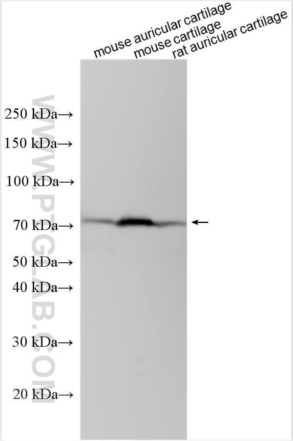Western Blot (WB) analysis of various lysates using ITIH1 Polyclonal antibody (21141-1-AP)