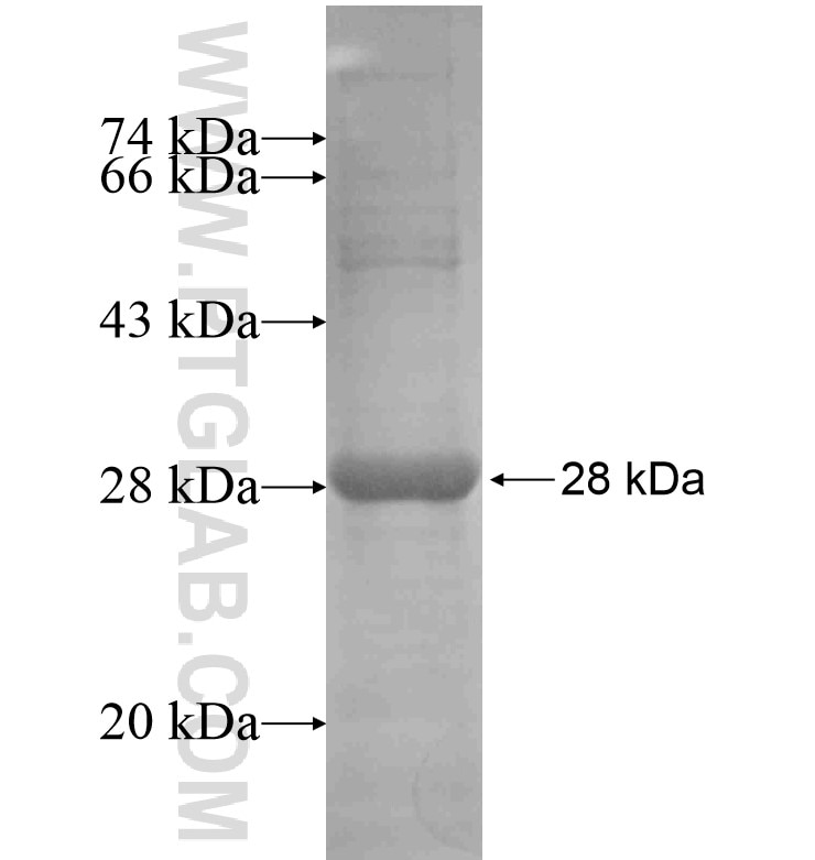 ITIH1 fusion protein Ag16540 SDS-PAGE