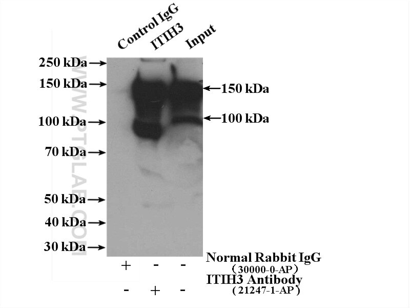 Immunoprecipitation (IP) experiment of human plasma using ITIH3 Polyclonal antibody (21247-1-AP)