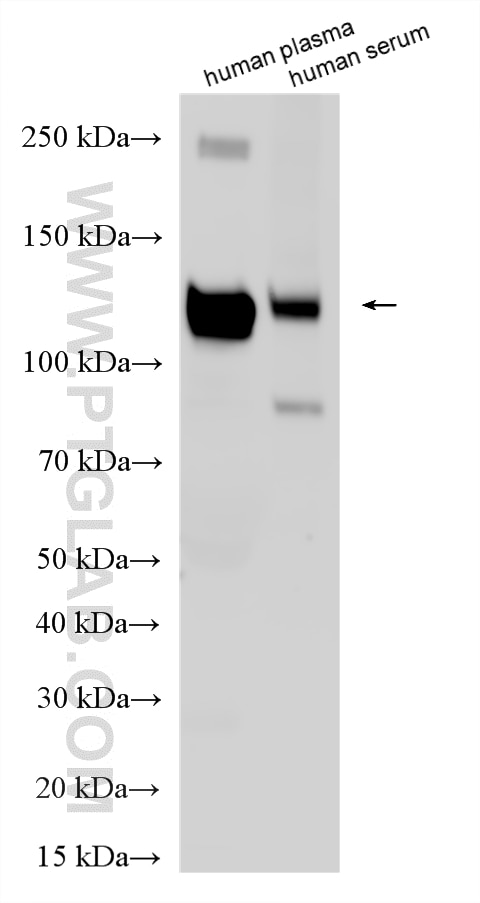 WB analysis using 21247-1-AP Western Blot (WB) analysis of various lysates using ITIH3 Polyclonal antibody (21247-1-AP)