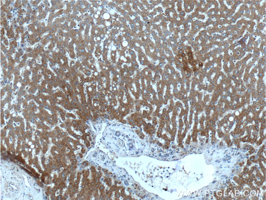 IHC staining of human liver using 24069-1-AP