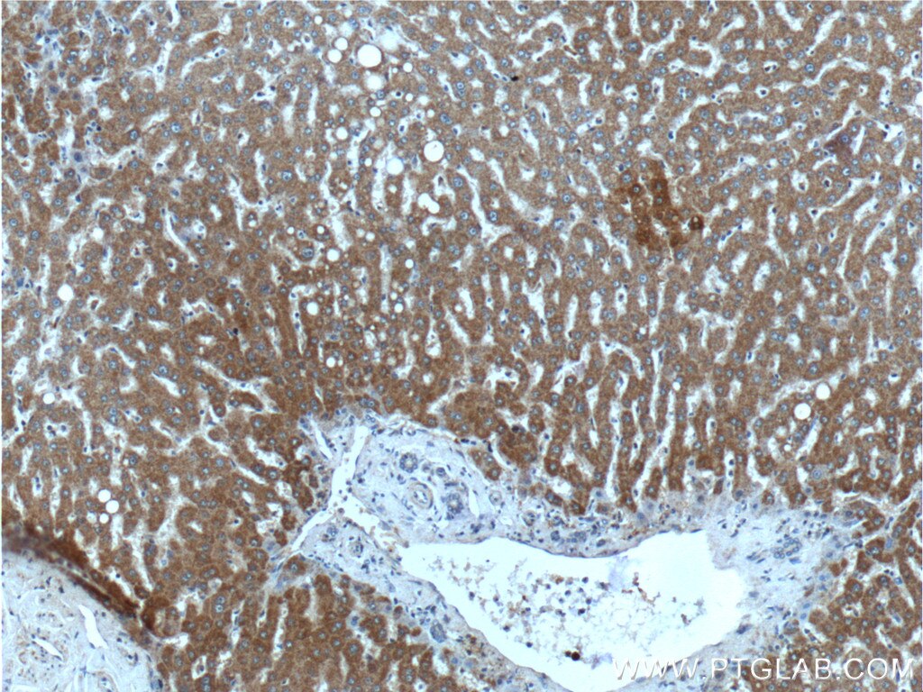 Immunohistochemistry (IHC) staining of human liver tissue using ITIH4 Polyclonal antibody (24069-1-AP)