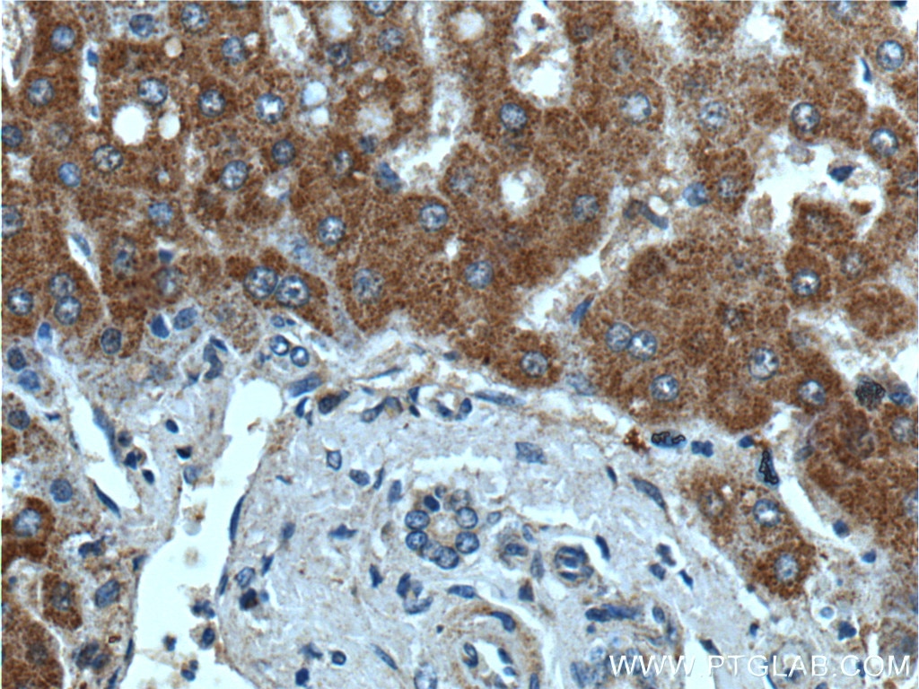 Immunohistochemistry (IHC) staining of human liver tissue using ITIH4 Polyclonal antibody (24069-1-AP)