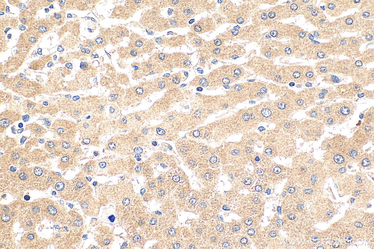 Immunohistochemistry (IHC) staining of human hepatocirrhosis tissue using ITIH4 Polyclonal antibody (24069-1-AP)