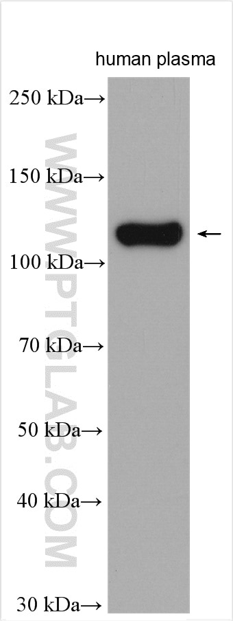 Western Blot (WB) analysis of human plasma using ITIH4 Polyclonal antibody (24069-1-AP)