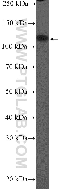 Western Blot (WB) analysis of mouse lung tissue using ITIH4 Polyclonal antibody (24069-1-AP)