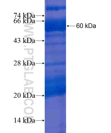 ITIH4 fusion protein Ag21275 SDS-PAGE