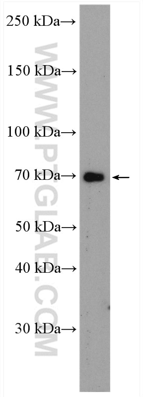 Western Blot (WB) analysis of mouse spleen tissue using ITK Polyclonal antibody (21525-1-AP)