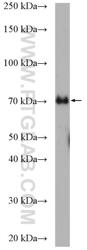 WB analysis of mouse spleen using 21525-1-AP