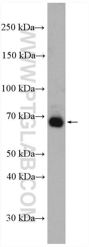 Western Blot (WB) analysis of Jurkat cells using ITK Polyclonal antibody (21525-1-AP)
