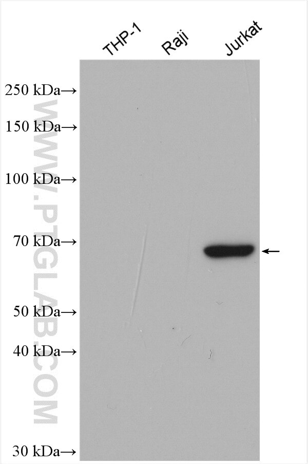 Western Blot (WB) analysis of various lysates using ITK Polyclonal antibody (21525-1-AP)