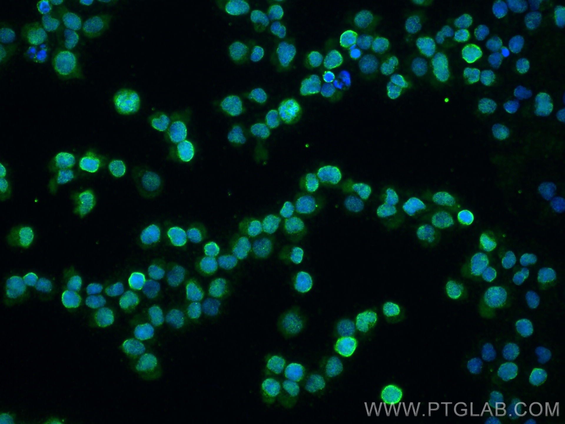 Immunofluorescence (IF) / fluorescent staining of Jurkat cells using ITK Monoclonal antibody (67703-1-Ig)