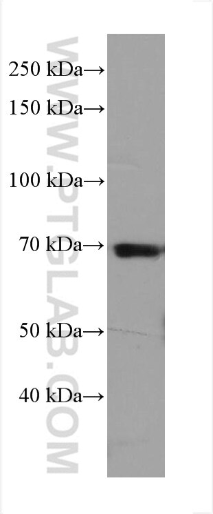Western Blot (WB) analysis of PBMC using ITK Monoclonal antibody (67703-1-Ig)
