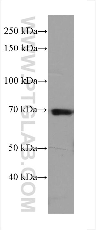 WB analysis of PBMC using 67703-1-Ig