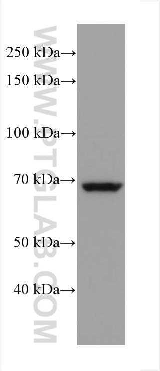 Western Blot (WB) analysis of Jurkat cells using ITK Monoclonal antibody (67703-1-Ig)
