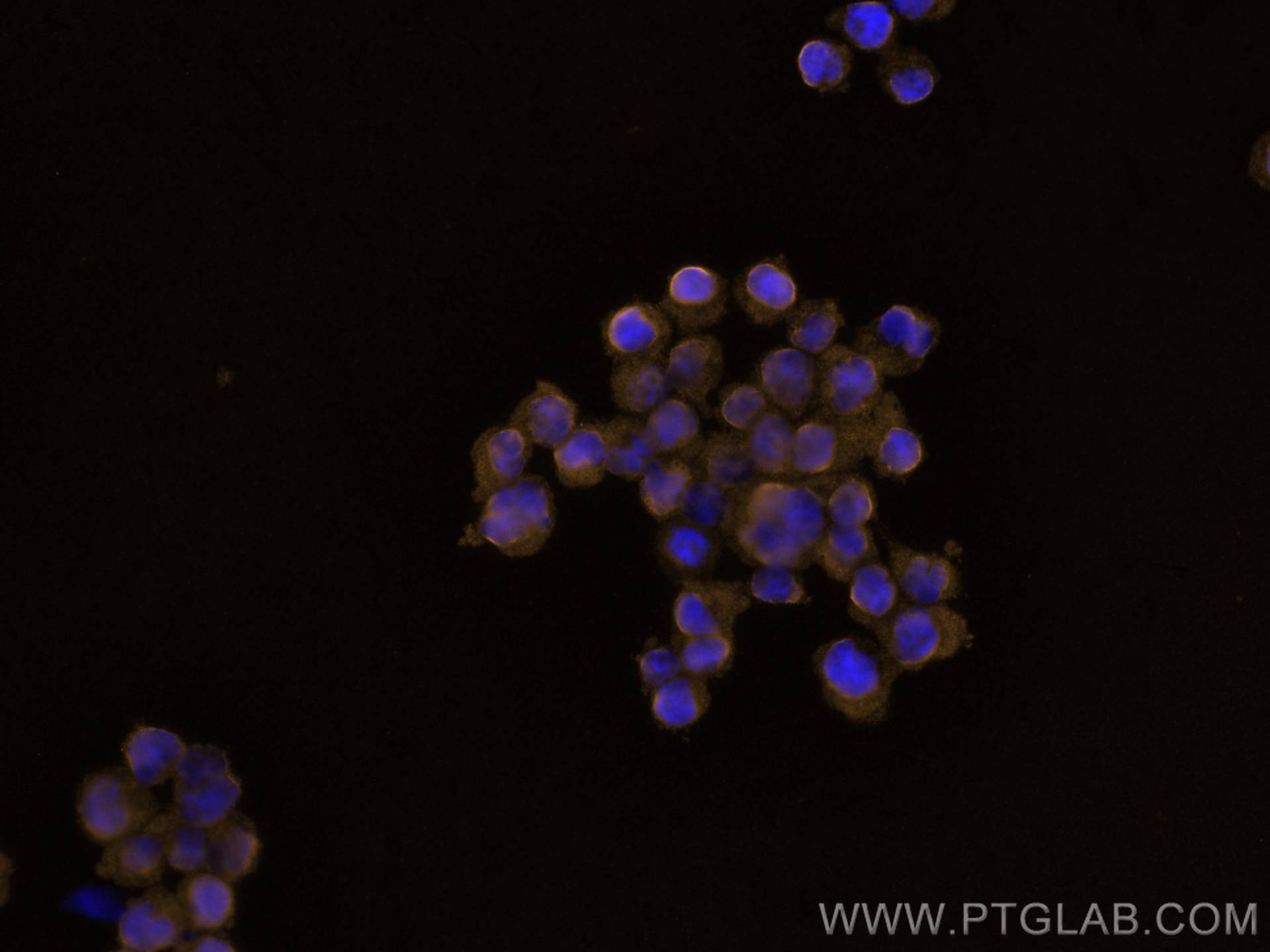 Immunofluorescence (IF) / fluorescent staining of Jurkat cells using CoraLite®555-conjugated ITK Polyclonal antibody (CL555-21525)