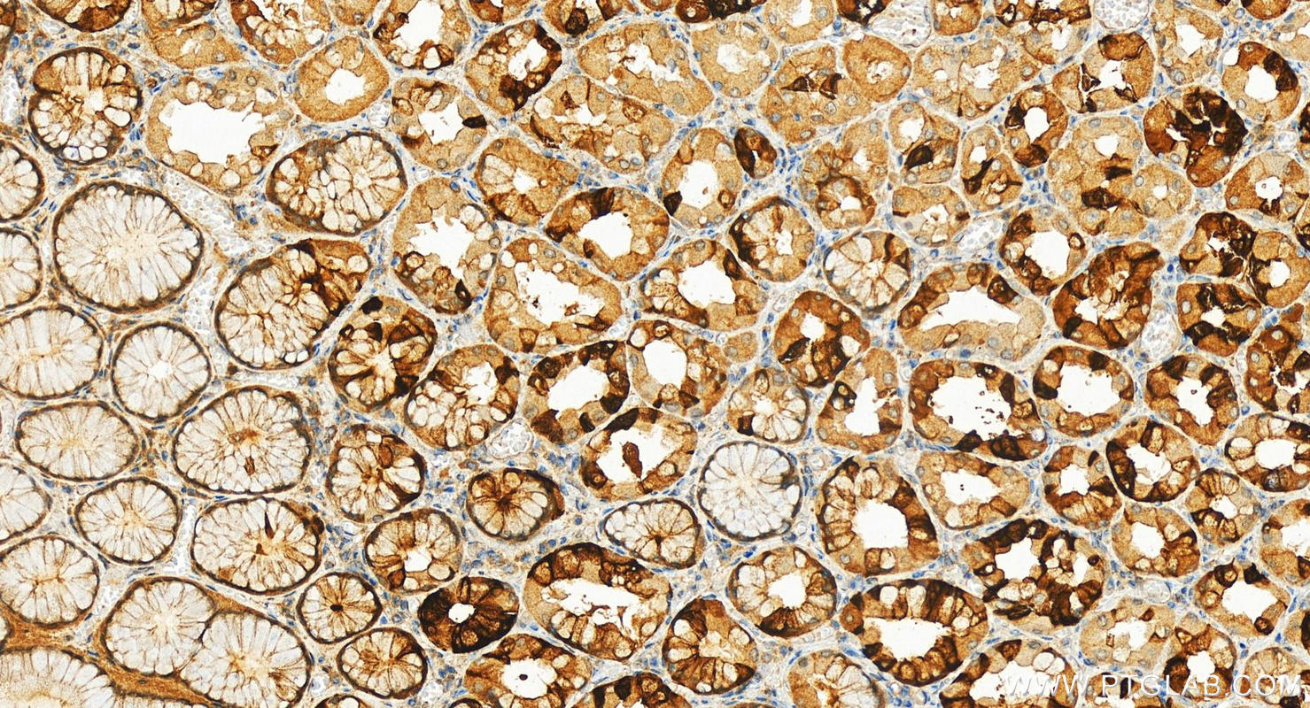 Immunohistochemistry (IHC) staining of human stomach tissue using ITLN1/2 Polyclonal antibody (11770-1-AP)