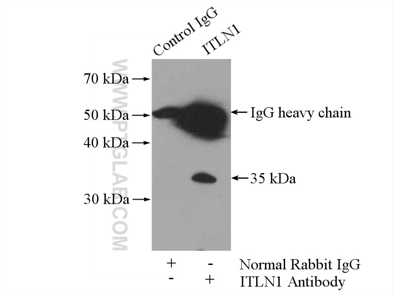 IP experiment of mouse appendix using 11770-1-AP