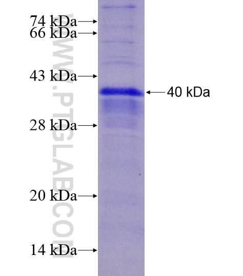 ITLN1 fusion protein Ag28617 SDS-PAGE