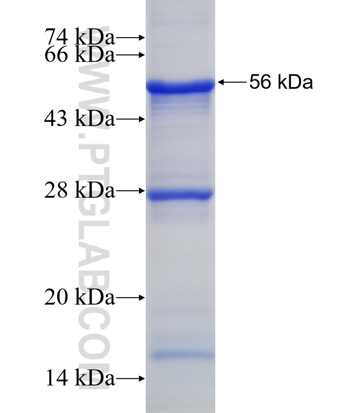 ITLN1 fusion protein Ag2424 SDS-PAGE