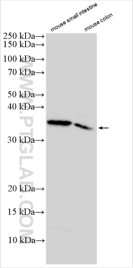 Western Blot (WB) analysis of various lysates using ITLN2 Polyclonal antibody (18815-1-AP)
