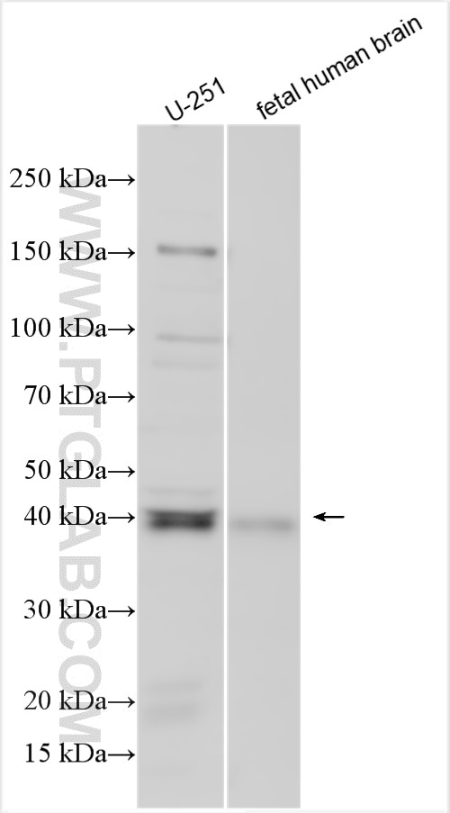 Western Blot (WB) analysis of various lysates using ITM2B Polyclonal antibody (12193-1-AP)