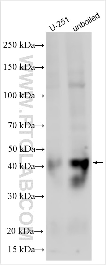 Western Blot (WB) analysis of various lysates using ITM2B Polyclonal antibody (12193-1-AP)