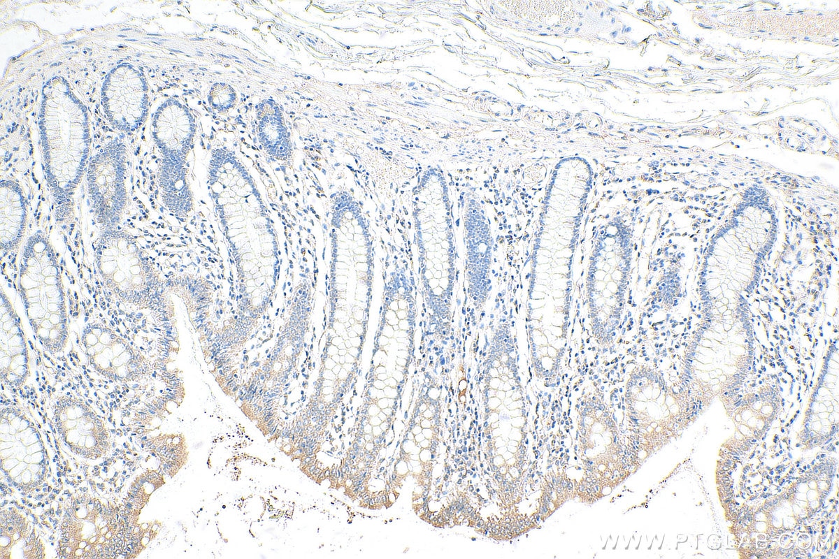 IHC staining of human colon using 13601-1-AP