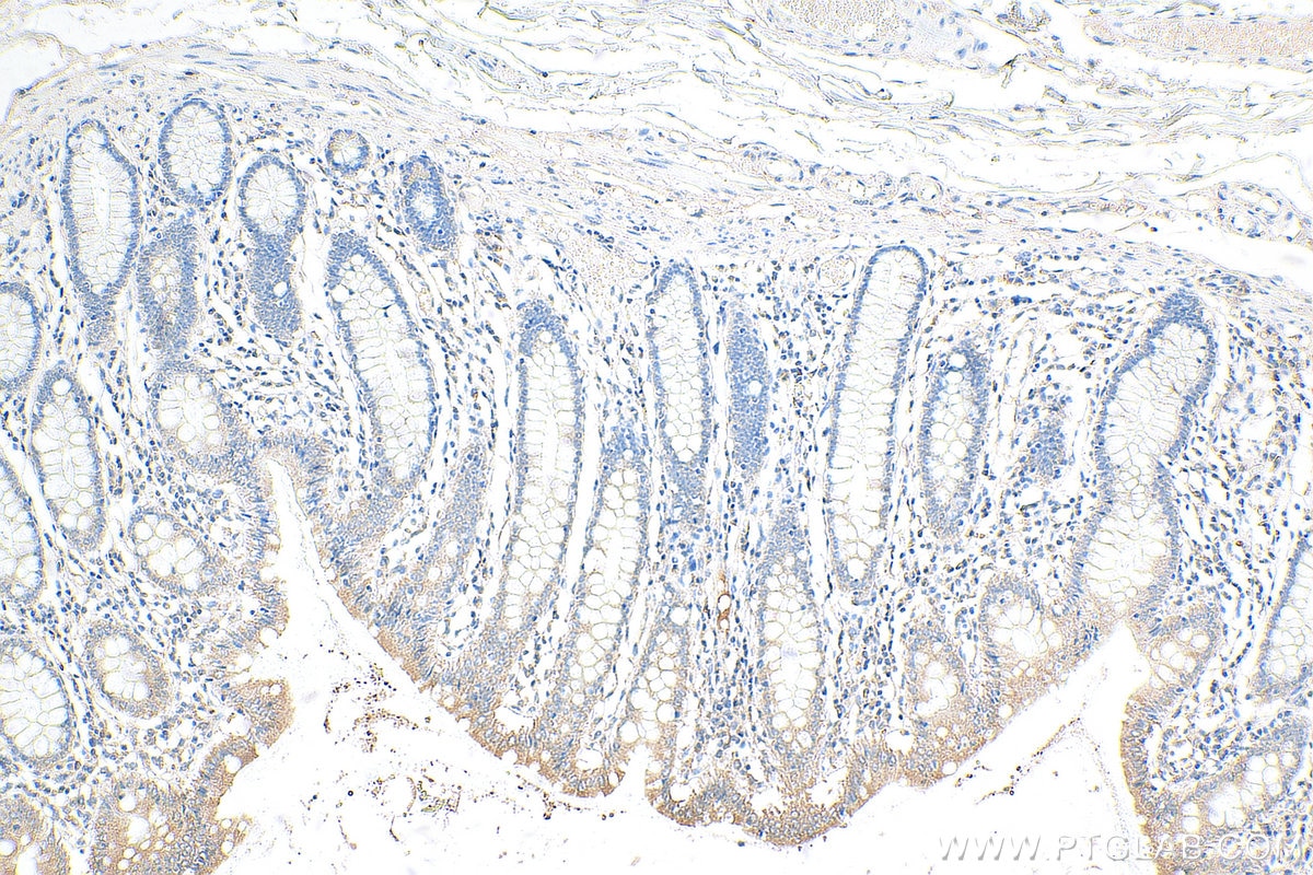 Immunohistochemistry (IHC) staining of human colon tissue using ITM2C Polyclonal antibody (13601-1-AP)