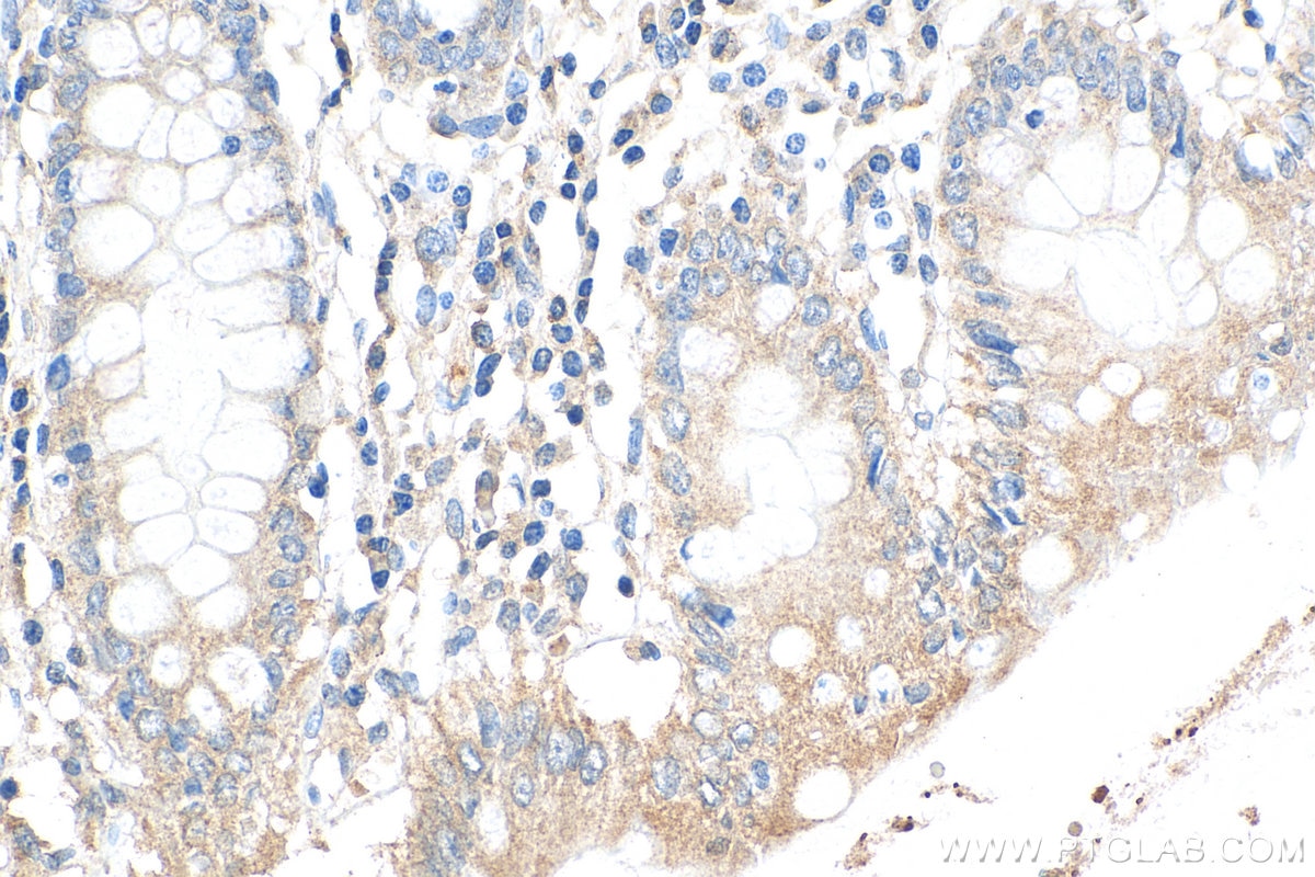 Immunohistochemistry (IHC) staining of human colon tissue using ITM2C Polyclonal antibody (13601-1-AP)