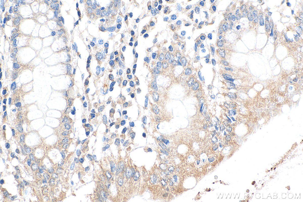 IHC staining of human colon using 13601-1-AP