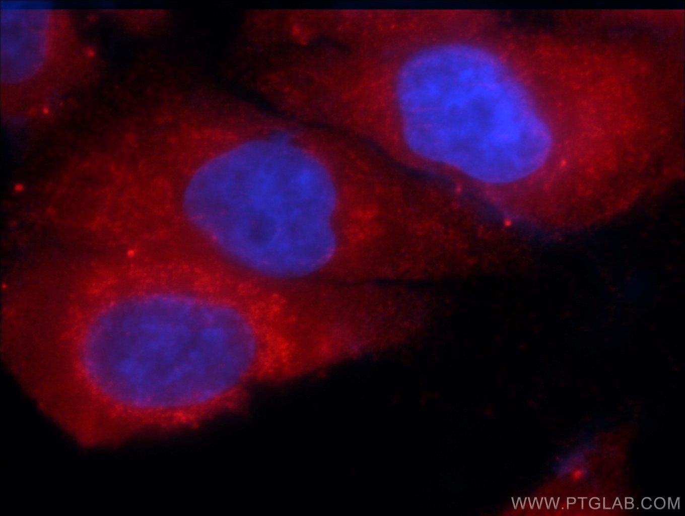 ITM2C Monoclonal antibody