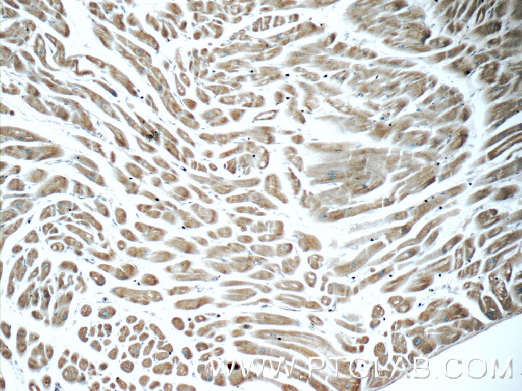 Immunohistochemistry (IHC) staining of human heart tissue using ITPA Polyclonal antibody (16134-1-AP)