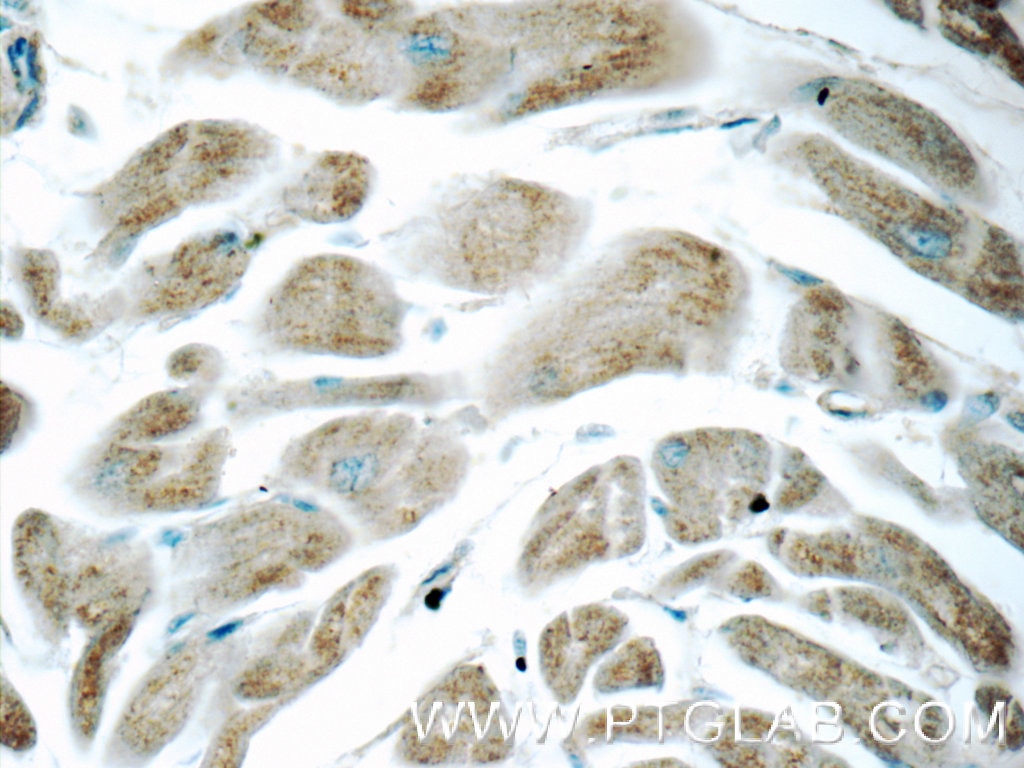 Immunohistochemistry (IHC) staining of human heart tissue using ITPA Polyclonal antibody (16134-1-AP)