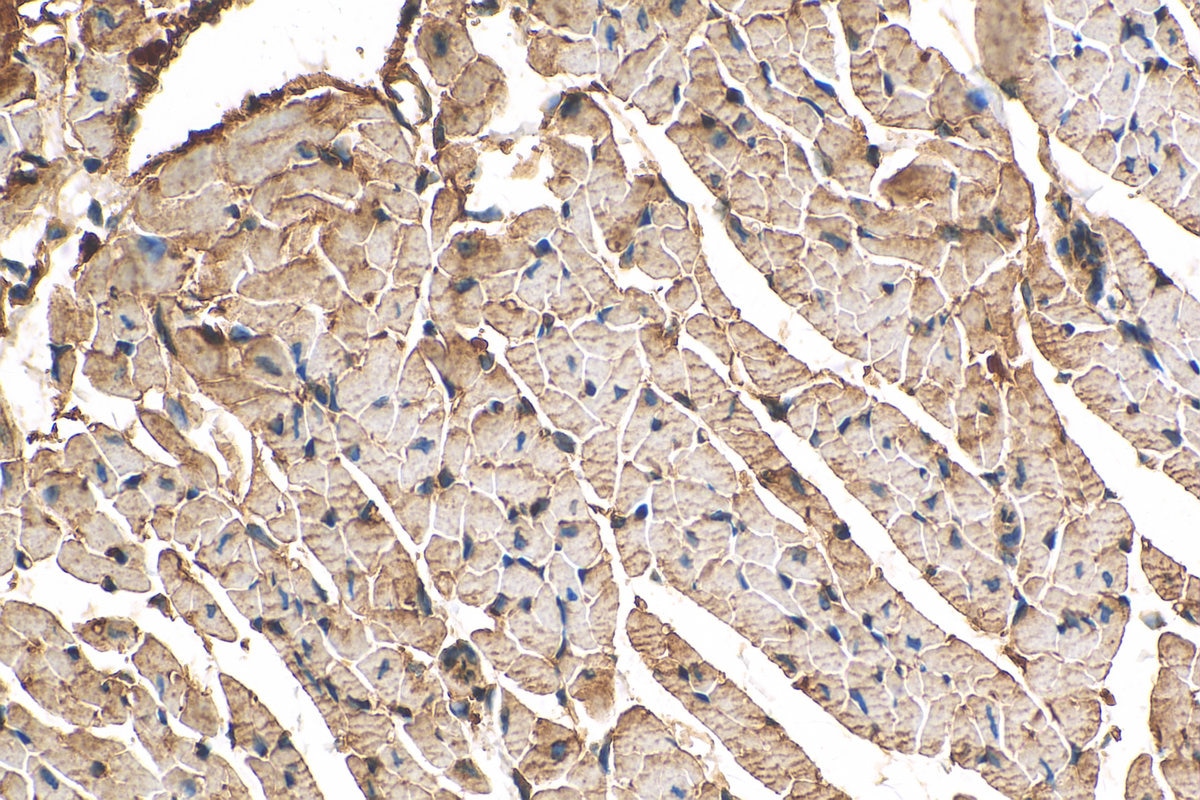Immunohistochemistry (IHC) staining of mouse heart tissue using ITPA Polyclonal antibody (16134-1-AP)
