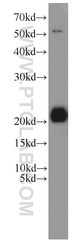 Western Blot (WB) analysis of K-562 cells using ITPA Polyclonal antibody (16134-1-AP)